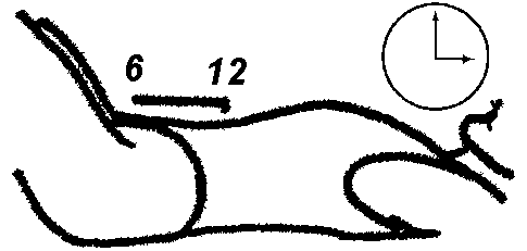 Pelvic Alignment Exercise - Looking Straight 
		Ahead
